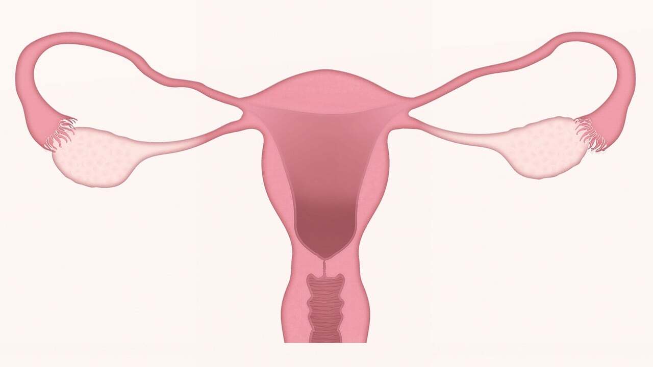 ivf for diminished ovarain reserve